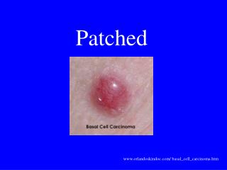 Patched