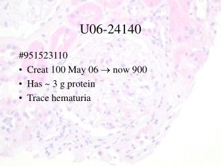 U06- 24140