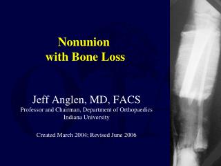 Nonunion with Bone Loss