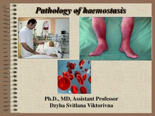 Pathology of h а emostasis