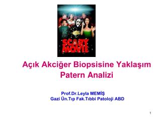 Açık Akciğer Biopsisine Yaklaşım Patern Analizi