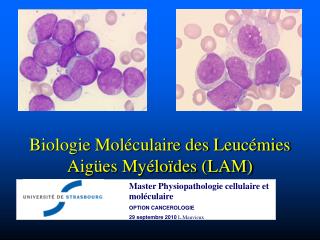 Biologie Moléculaire des Leucémies Aigües Myéloïdes (LAM)