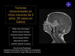 Tumores intracraneales en niños menores de 3 años: 25 casos en Galicia