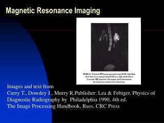 Magnetic Resonance Imaging