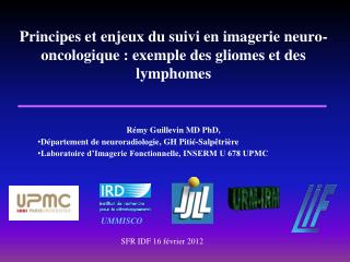 Principes et enjeux du suivi en imagerie neuro-oncologique : exemple des gliomes et des lymphomes