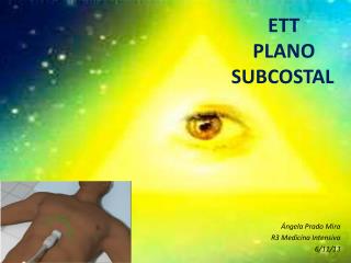 ETT PLANO SUBCOSTAL