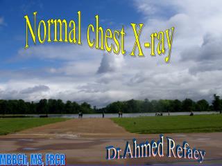 Normal chest X-ray
