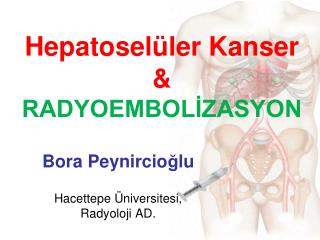 Hepatoselüler Kanser &amp; RADYOEMBOLİZASYON