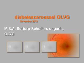 diabetescaroussel OLVG November 2012