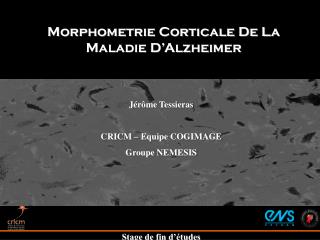 Morphometrie Corticale De La Maladie D’Alzheimer