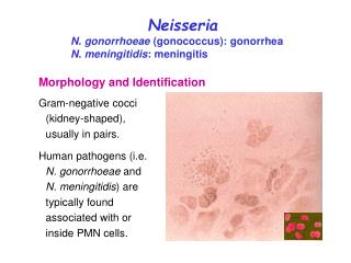 Neisseria N. gonorrhoeae (gonococcus): gonorrhea N. meningitidis : meningitis