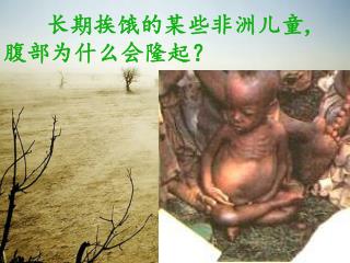 长期挨饿的某些非洲儿童 , 腹部为什么会隆起？