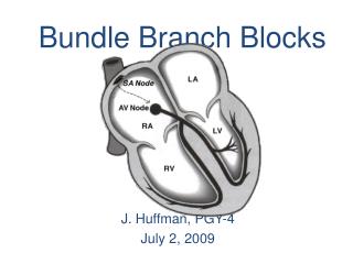 Bundle Branch Blocks