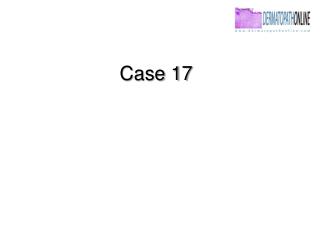 Case 17