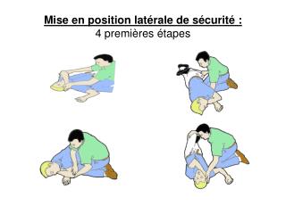 Mise en position latérale de sécurité : 4 premières étapes