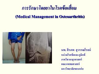 การรักษาโดยยาในโรคข้อเสื่อม ( Medical Management in Osteoarthritis)