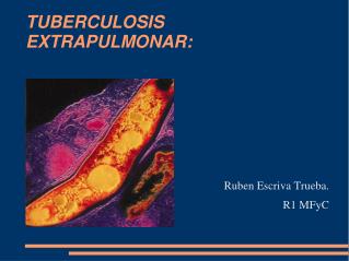 TUBERCULOSIS EXTRAPULMONAR: