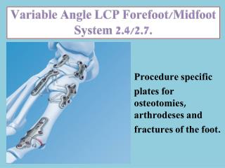 Variable Angle LCP Forefoot/ Midfoot System 2.4/2.7.