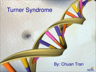 Turner Syndrome