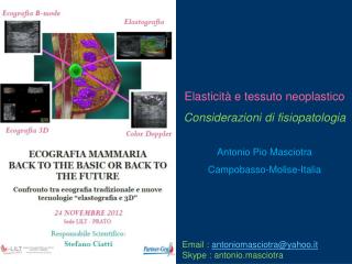 Elasticità e tessuto neoplastico Considerazioni di fisiopatologia Antonio Pio Masciotra