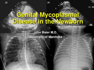 Genital Mycoplasmal Disease in the Newborn