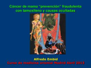 Cáncer de mama “prevención” fraudulenta con tamoxifeno y causas ocultadas