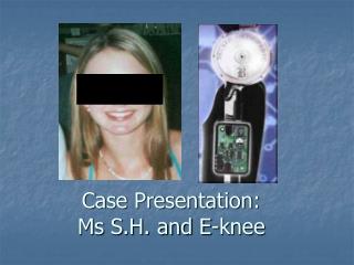 Case Presentation: Ms S.H. and E-knee