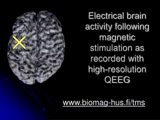 Electrical brain activity following magnetic stimulation as recorded with high-resolution Q EEG