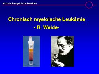Chronisch myeloische Leukämie - R. Weide-
