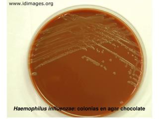 Haemophilus influenzae : colonias en agar chocolate