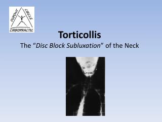 Torticollis The “ Disc Block Subluxation ” of the Neck