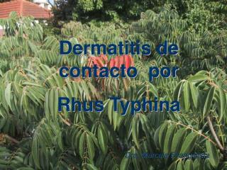 Dermatitis de contacto por Rhus Typhina