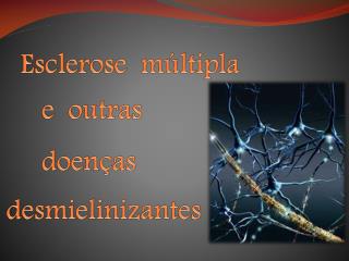 Esclerose múltipla e outras doenças desmielinizantes