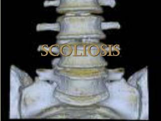 Scoliosis