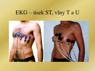 EKG – úsek ST, vlny T a U