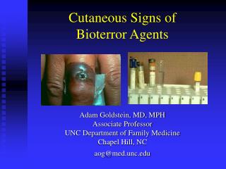 Cutaneous Signs of Bioterror Agents