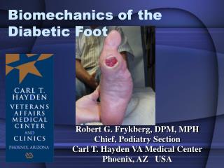 Biomechanics of the Diabetic Foot