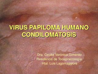 VIRUS PAPILOMA HUMANO CONDILOMATOSIS