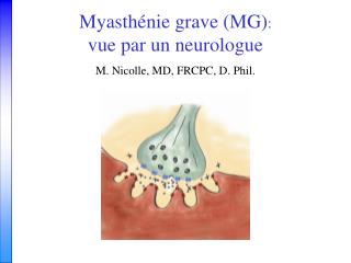 Myasthénie grave (MG) : vue par un neurologue