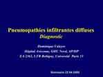 Pneumopathies infiltrantes diffuses Diagnostic