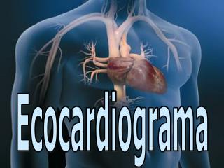 Ecocardiograma