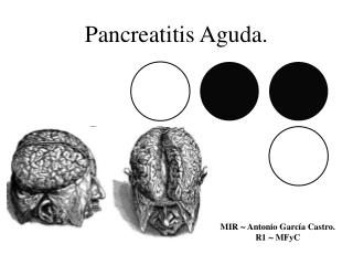Pancreatitis Aguda.