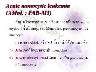 Acute monocytic leukemia (AMoL : FAB-M5)