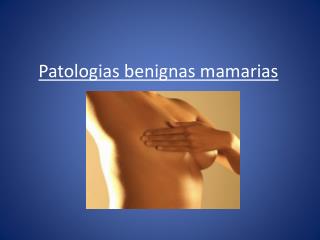 Patologias benignas mamarias