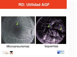 RD : Utilidad AGF