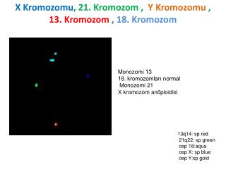 X Kromozomu , 21. Kromozom , Y Kromozomu , 13. Kromozom , 18. Kromozom