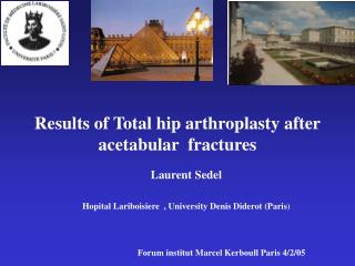 Results of Total hip arthroplasty after acetabular fractures