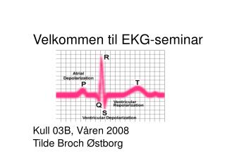 Velkommen til EKG-seminar Kull 03B, Våren 2008 Tilde Broch Østborg