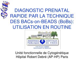 DIAGNOSTIC PRENATAL RAPIDE PAR LA TECHNIQUE DES BACs-on-BEADS (BoBs): UTILISATION EN ROUTINE