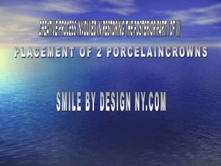 CREATIVE PROCESS INVOLVED IN RESTORING THE POSTERIOR PART I OF III